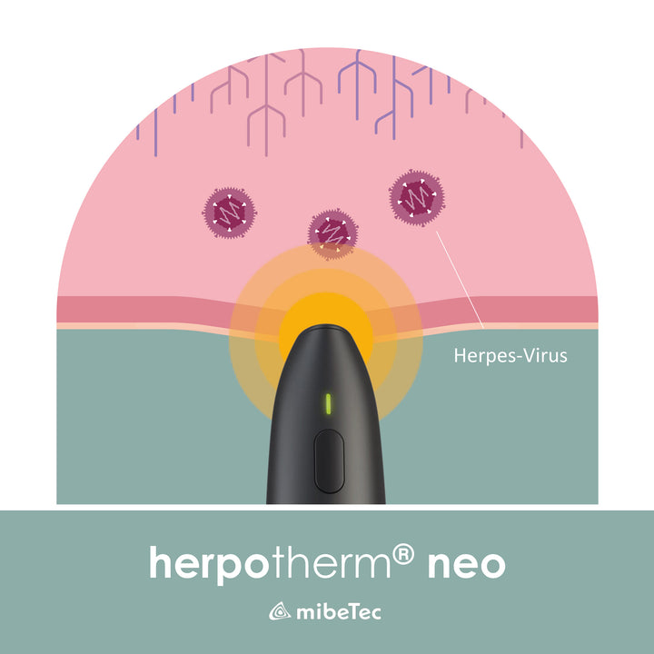 mibeTec herpotherm® neo